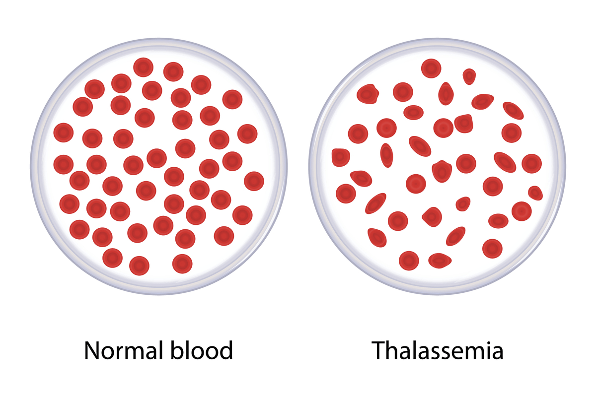 Dr. Vikas Dua - Best Thalassemia Transplant Doctors In India